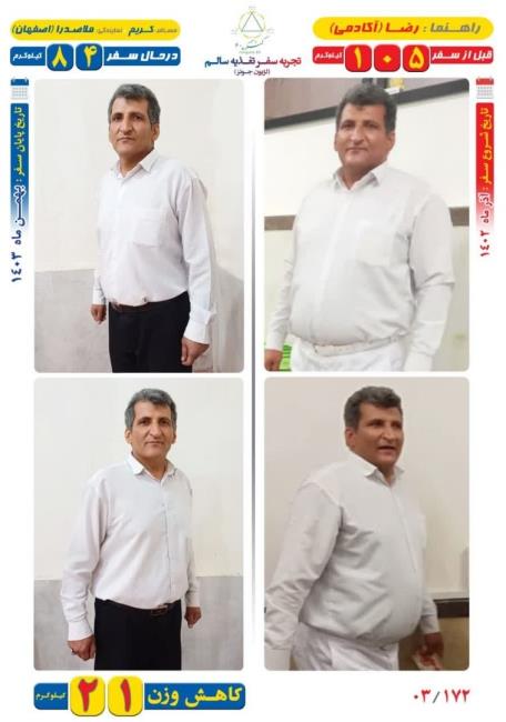 21 کیلوگرم کاهش وزن مسافر کریم به روش Dezhakam 