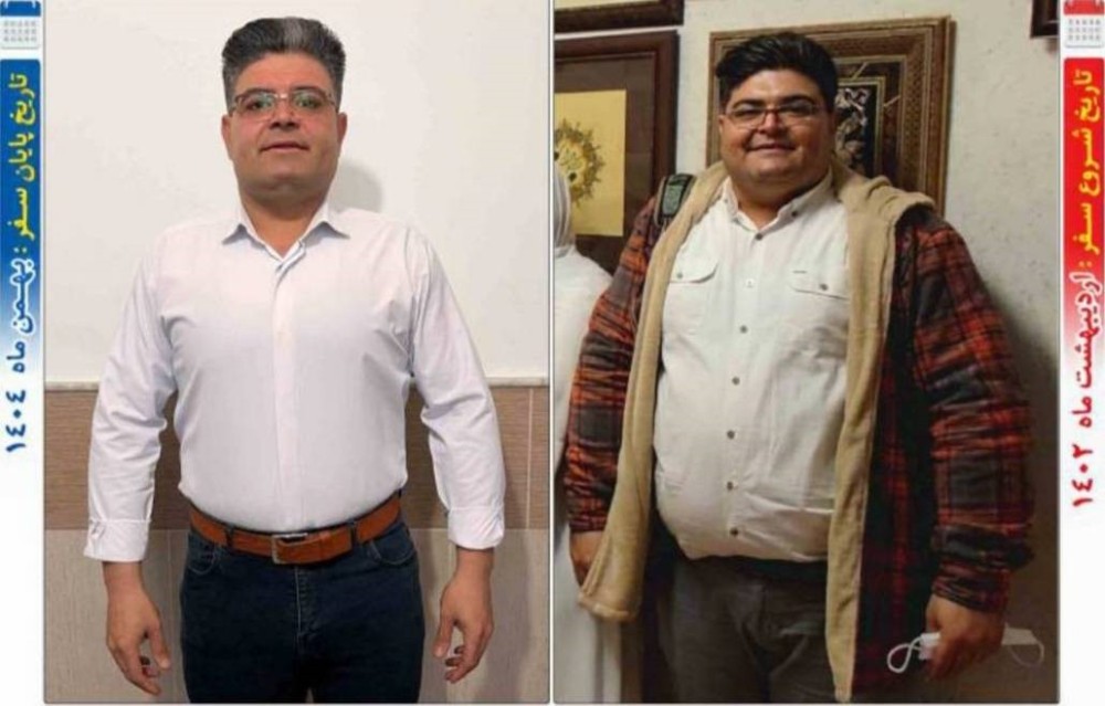 چاقی فقط مربوط به زیاد خوردن نیست